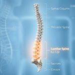 Spine Surgery